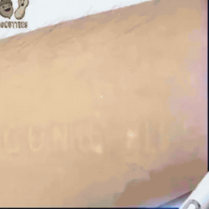 BluePoint™ Laserowe pióro wspierające regenerację skóry nóg